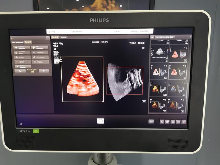 Gebraucht Philips EPIQ 5W Elite X Matrix Heart Model Diagnostik Ultraschall-System SW 7.0.3 mit drei Sonden und Drücker