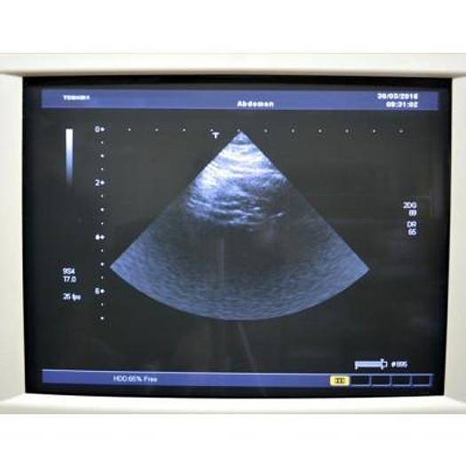 Used TOSHIBA APLIO 80 XARIO AVEC 4 SONDES