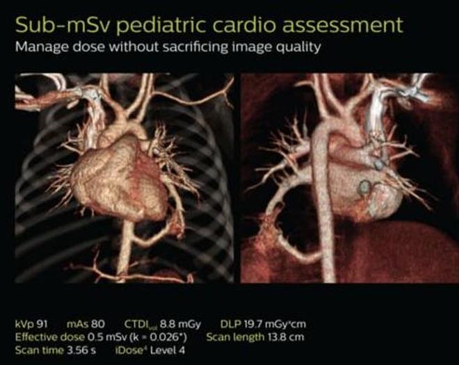 Usado Resonancia Magnética PHILIPS Achieva TX 3.0T