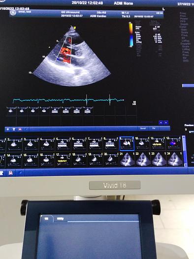 Gebraucht GE Vivid T8