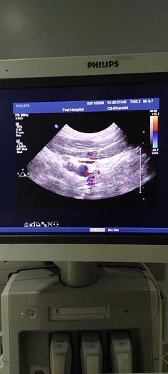 Gebraucht Philips C8-5 Microkonvex Sonde