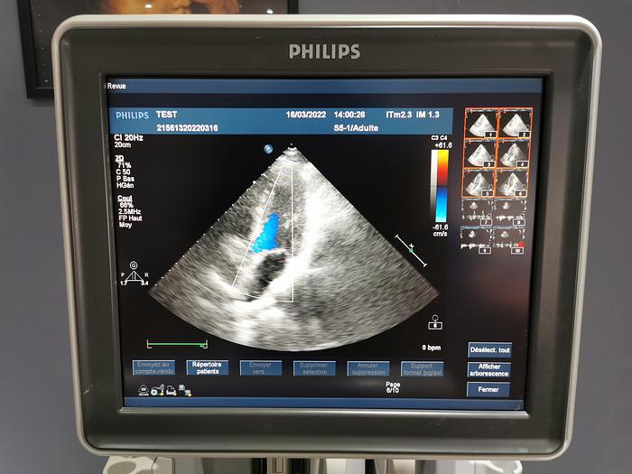 Gebraucht Philips,HX57