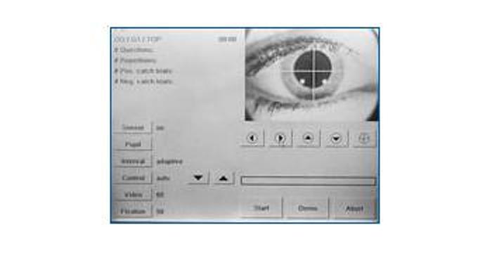 Refurbished Haag Streit Octopus 311 Visual Field Perimeter