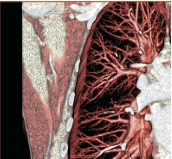 Refurbished 2010 General Electric (GE) LightSpeed VCT