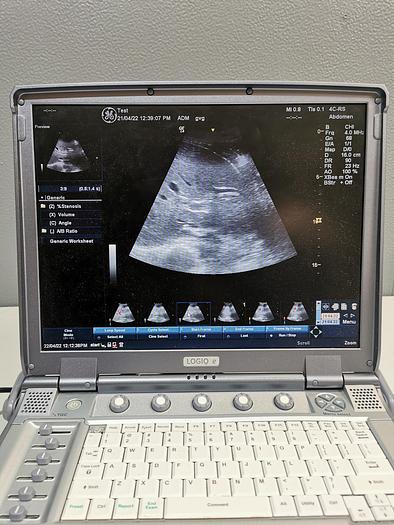 Gebraucht GE LOGIQ e  Tragbare Ultraschallgerät im Koffer mit zwei Sonden
