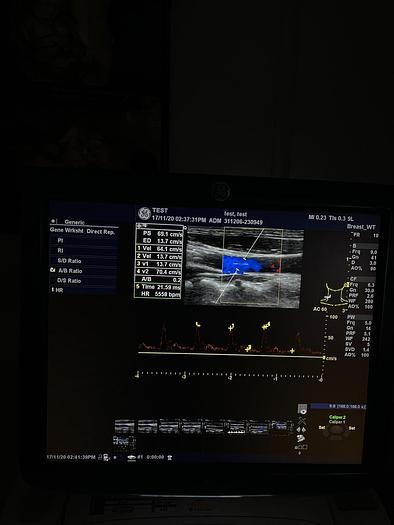 Used GE LOGIQ E9 Ultraschalgerät mit Drucker und 3 Sonden