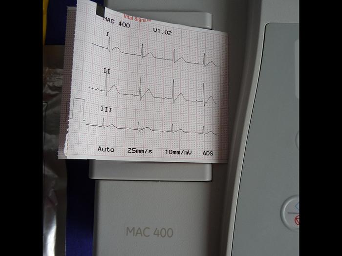 Gebraucht EKG GE MAC 400 mit Zubehör