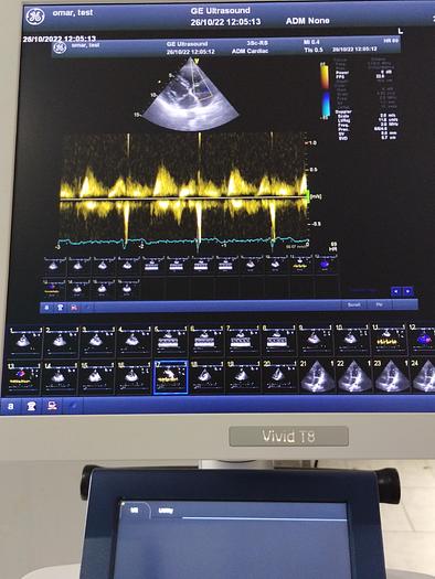 Gebraucht GE Vivid T8