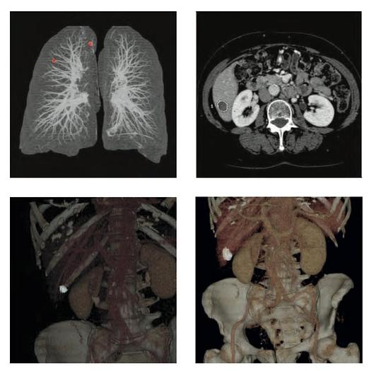 Used 2018 General Electric (GE) Optima CT660