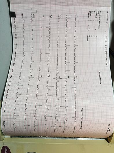 Gebraucht GE-Medical-System-EKG-0700