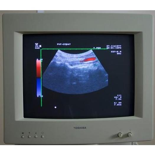 Usato ECHOGRAPHE COULEUR DOPPLER TOSHIBA ECOCEE SSA 340