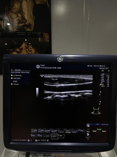Used GE LOGIQ E9 Ultraschalgerät mit Drucker und 3 Sonden