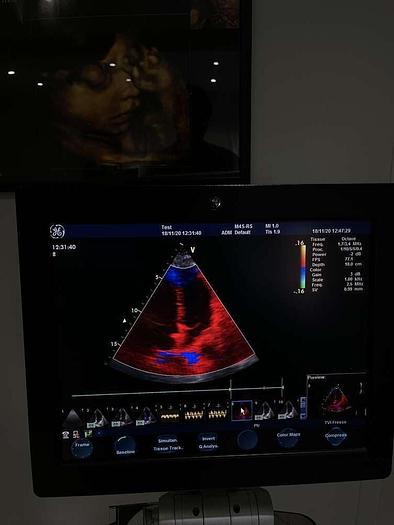 Gebraucht GE Vivid S6 Ultraschallsystem mit Sony Drucker und 1x Sonde