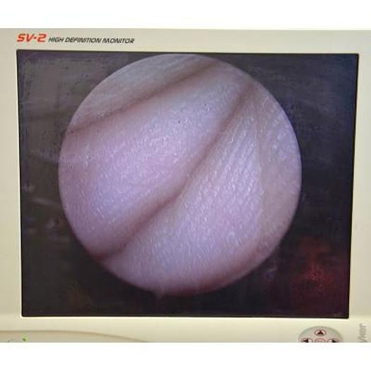 Used COLONNE DE COELIOCHIRURGIE STRYKER