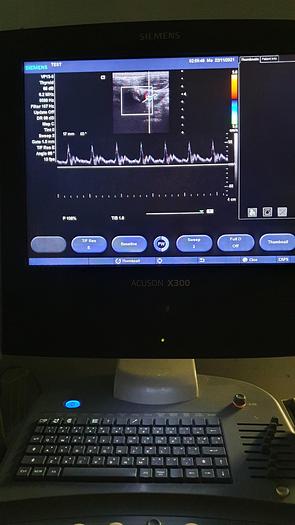 Gebraucht Siemens Acuson X300
