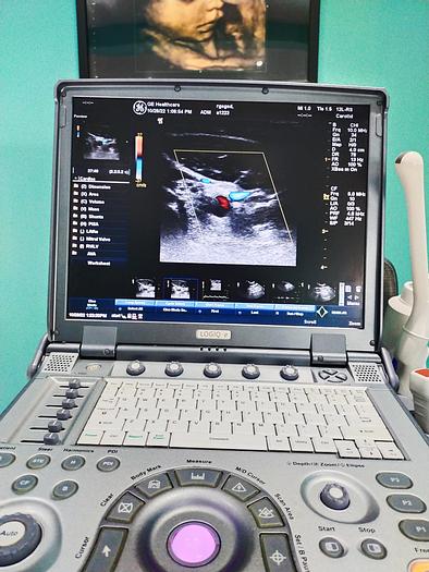 Gebraucht GE LOGIQ e tragbare Ultraschallgerät inkl. 2 Sonden und Mitsubishi P93 Drucker