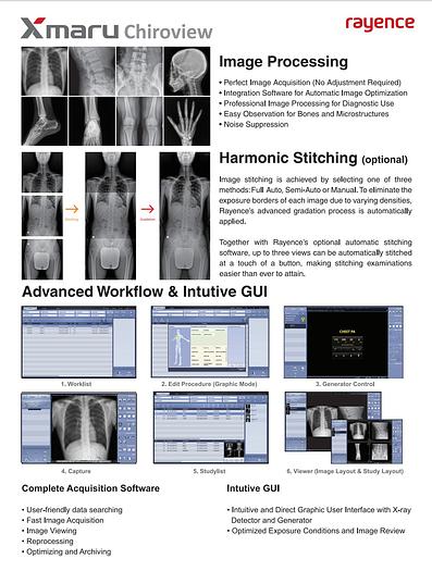 Rayence DCX Digital Chiropractic X-Ray (New)