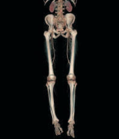 Reformado GE LightSpeed VCT