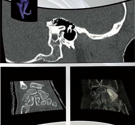 Refurbished 2008 General Electric (GE) LightSpeed VCT