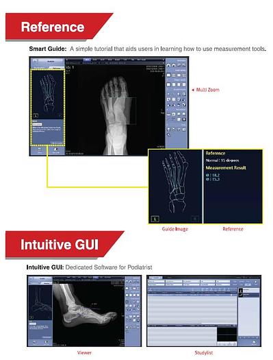 Used Rayence X-Cel 715BDXC Podiatry X-Ray