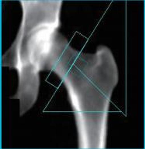 Used GE Lunar Densitometer 2012