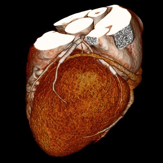 Reformado 2005 Toshiba Aquilion 64/120
