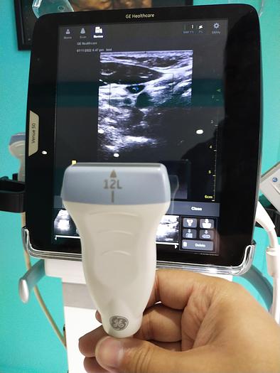 Gebraucht GE Healthcare Ultraschalgerät mit 2 Sonden