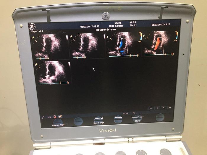 Gebraucht GE Vivid i Ultraschallsystem mit Kardio Sonde Software Version 2.1.16 auf GE Vivid i Trolley
