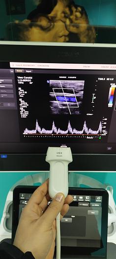 Gebraucht L12-3 ERGO Breitband-Linear-Schallkopf
