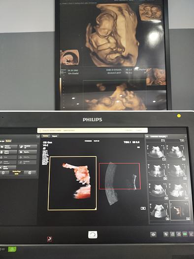 Gebraucht Philps EQIP 5W 1341