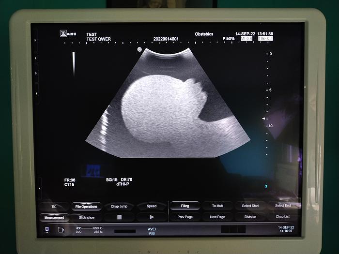 Gebraucht Hitachi Hi Vision Preirus Ultraschallgerät inkl. 3 Sonden, 