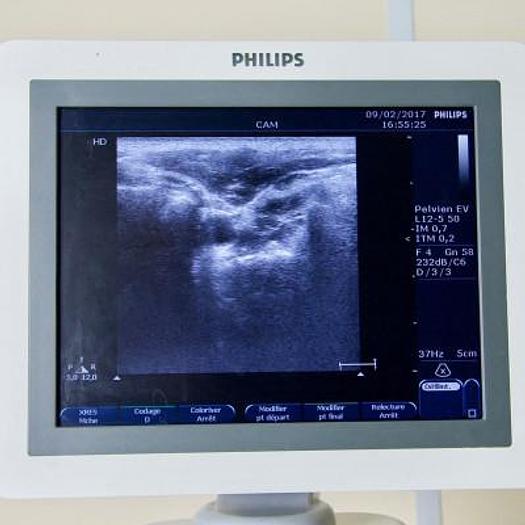 Used ECHOGRAPHE COULEUR DOPPLER PHILIPS HD 7 XE AVEC 3 SONDES