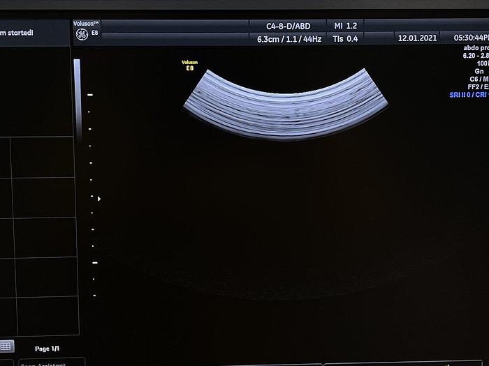 Gebraucht GE Voluson E8 Ultraschallgerät mit  2x neue Sonde + 1x gebrauchte sonde + Sony Drucker