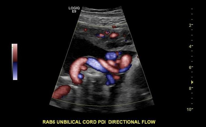 Used 2015 General Electric (GE) Logiq E9