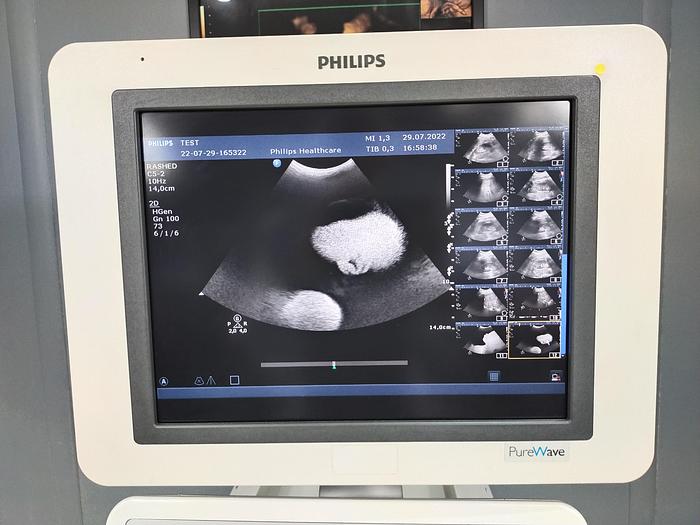 Gebraucht Philips HD15 Purewave Diagnostik Ultraschallsystem mit zwei Sonden und Printer SW 3.0.1