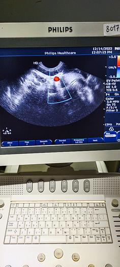 Gebraucht Philips C8-4V Transvaginal Ultraschallsonde