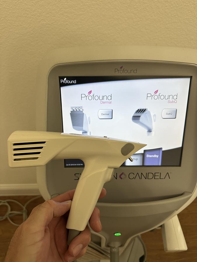 Used 2011 Syneron Candela Profound RF Micorneedling