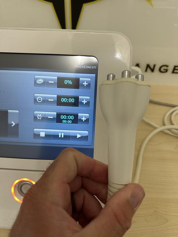 Used 2017 Venus Viva RF Microneedling