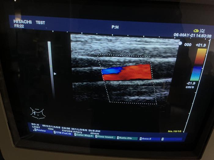 Gebraucht Hitachi EUB-6500