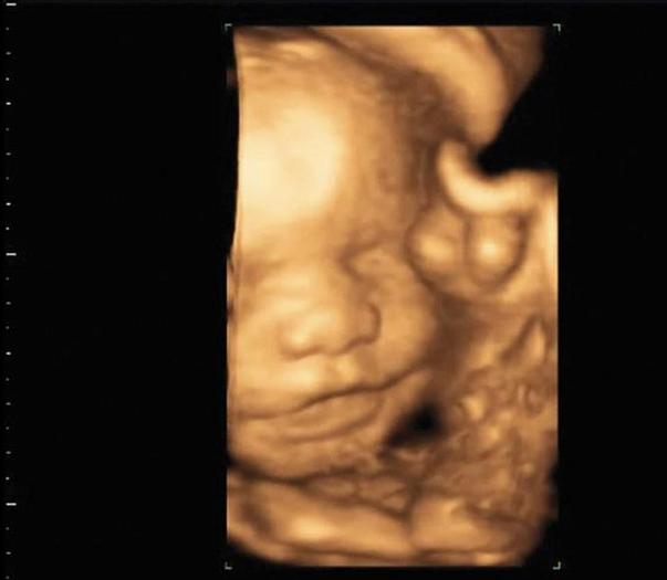 Used 2015 General Electric (GE) Logiq E9