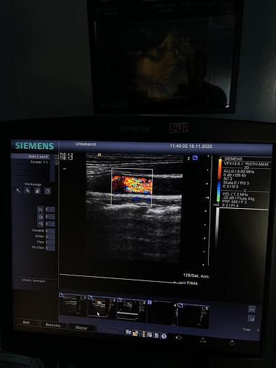 Gebraucht Siemens Acuson Antares Ultrschallsystem mit 3x Sonden, Mitsubishi P93D Drucker, DVD Recorder