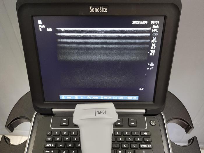 Gebraucht Sonosite Edge Ultraschallgerät inkl. 2 Sonden und Sony UP-D897 Drucker