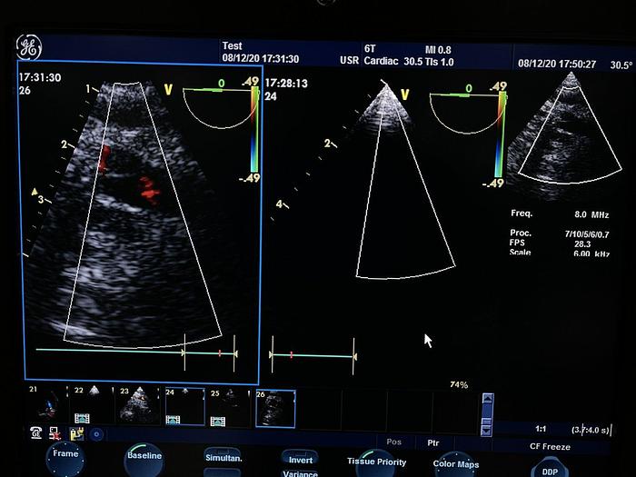 Gebraucht GE 6T Transösophageale Ultraschallsonde TEE Schlucksonde