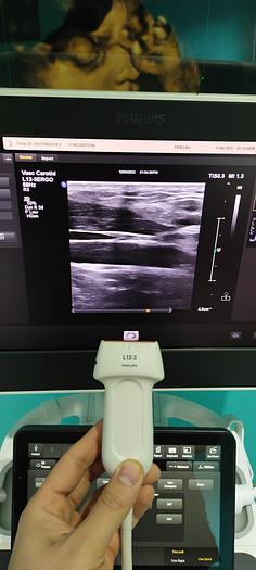 Gebraucht L12-3 ERGO Breitband-Linear-Schallkopf