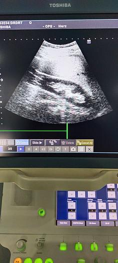 Gebraucht Toshiba PVT-375BT konvex Ultraschallsonde