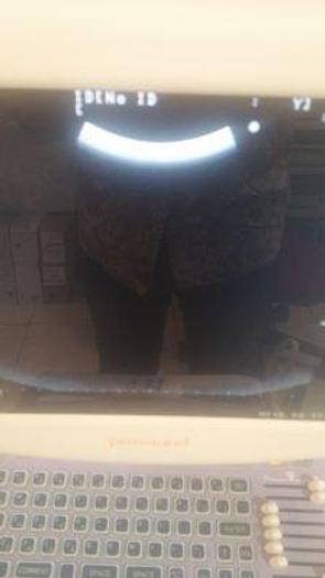 Used ALOKA Prosound 6 OB / GYN Ultrasound