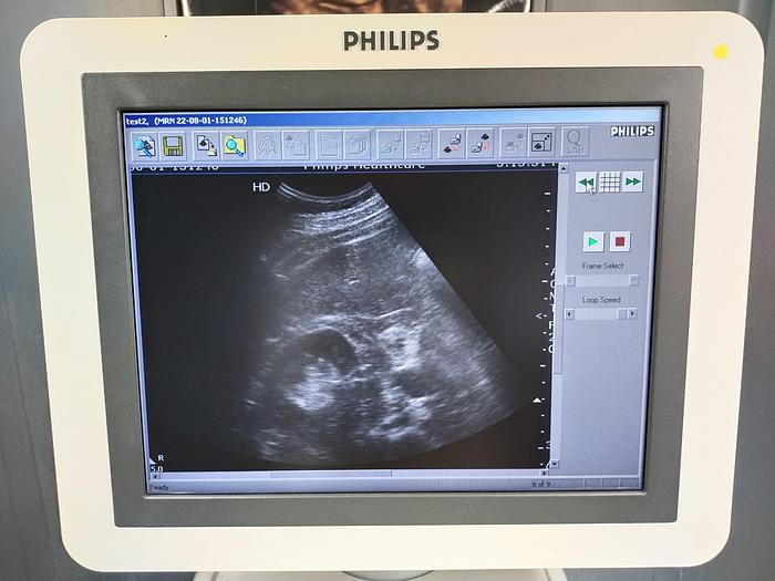 Gebraucht Philips HD7 XE Diagnostik Ultraschallsystem mit konvex Sonde, Drucker und DVD Brenner