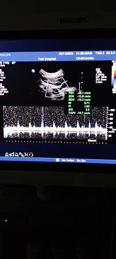 Gebraucht Philips C8-5 Microkonvex
