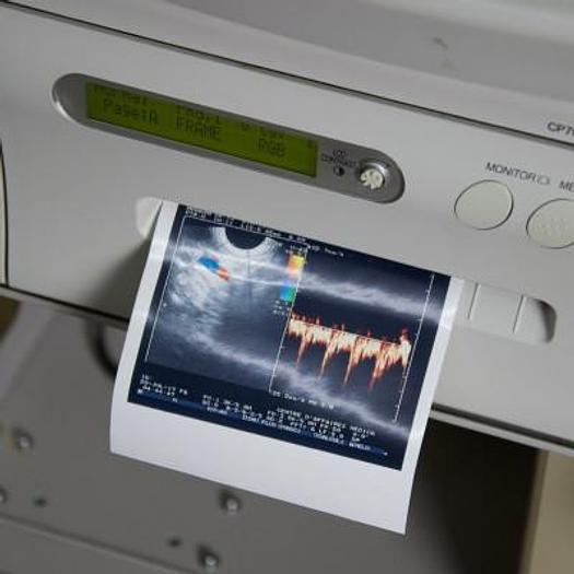 D'occasion ECHOGRAPHE DOPPLER HITACHI ODYSSEE AVEC 3 SONDES