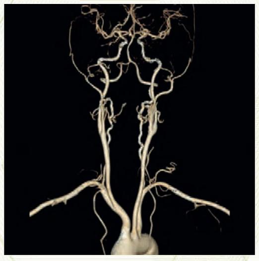 Used 2018 General Electric (GE) Optima CT660